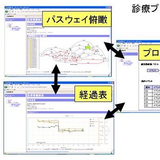 日本IBMと東邦大学、医療分野のビッグデータ分析システムを開発