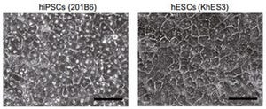 iPS細胞から肝細胞への分化特性の差はドナーの違いが大きな要因 - 京大