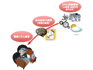 NCNP、「非同調型概日リズム睡眠障害」の原因は体内時計周期の異常と確認