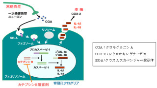 九大とJST、リウマチなど慢性痛の治療薬開発のための新たな糸口を解明