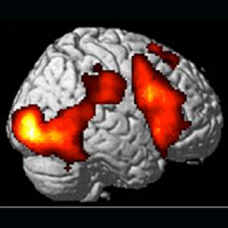 自閉症者は目と目で通じ合うのが苦手 - NIPSが脳活動の計測で確認