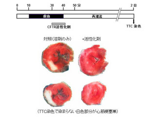 NIPSと仁愛大、心筋梗塞には「CFTRイオンチャネル」の活性化が有効と確認