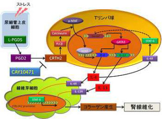 腎臓の線維化の進行抑制には「CRTH2受容体」の阻害が有効 - 慶応大など