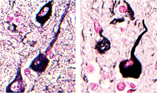 東大、ツシマヤマネコの脳にアルツハイマー病の特徴的病変を確認