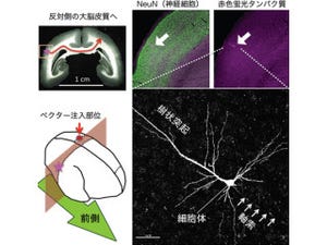 NIBBなど、脳の特定の部位の神経細胞の全体像を可視化する技術を開発