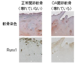 東大、変形性関節症の根本治療につながる低分子化合物とその作用機序を解明