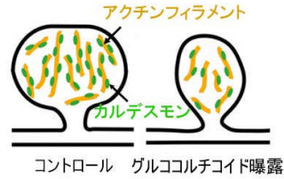 岩手医科大、ストレスによるシナプス形成障害の分子メカニズムを解明