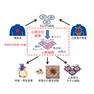 京大、安全な臨床グレードの心筋細胞をES/iPS細胞から生産する技術を確立