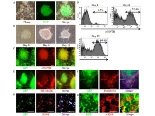 老マウスiPS細胞からのNCL細胞の移植が糖尿病性多発神経障害に有効 - 名大