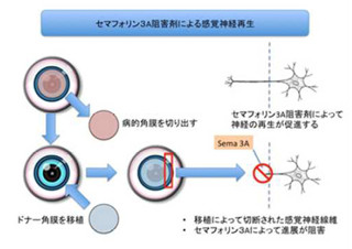 慶応大など、セマフォリン3A阻害剤による角膜の感覚神経再生にマウスで成功