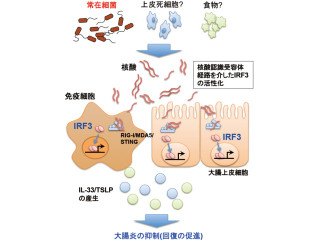 東大、自然免疫受容体経路の活性化が大腸炎を抑制する分子機構の1つを解明