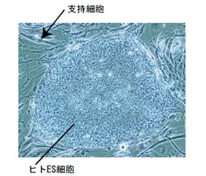京大、細胞接着タンパクを用いた安全/高効率なヒトES/iPS細胞培養法を開発