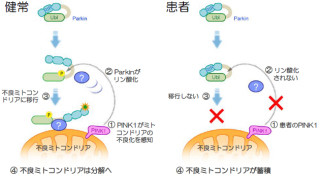 順天堂大、若年性遺伝性パーキンソン病の発症の仕組みの一部を解明