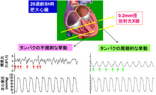 東大病院など、心臓カテーテル検査の実施を簡単に判定できる検査法を