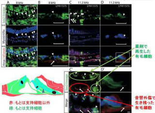 慶応大など、難聴において「蝸牛外有毛細胞」を再生させて聴力の改善に成功