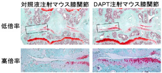 東大、変形性膝関節症をNotch阻害剤「DAPT」の注射で予防できることを確認