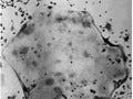 阪大とJST、破骨細胞が実際に骨を壊していく様子も撮影可能な顕微鏡を開発