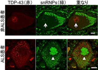 理研など、ALSとSMAの療法に共通する神経細胞変性のメカニズムの一端を解明