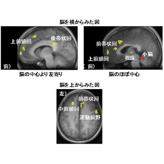 かむ動作を行うことで注意力と判断速度が向上する - 放医研が確認