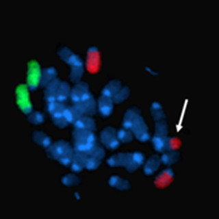 ISSに保存したES細胞を用いて放射線の影響を調査する研究を実施 -大阪市大