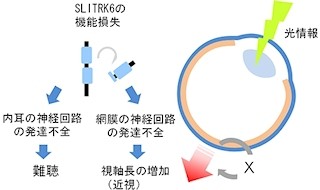 理研など、近視と難聴の合併症の原因となる遺伝子変異を発見