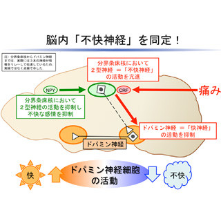 うつ病などの治療にも期待 -北大、なぜ痛みが不快感を引き起こすのかを解明