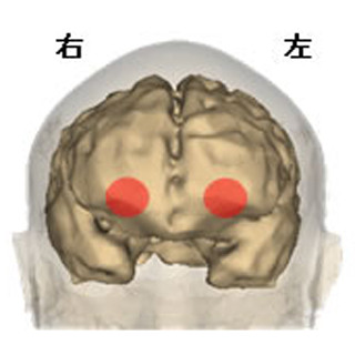 赤ちゃんの脳はおむつ素材の違いを区別している - 長崎大などが確認