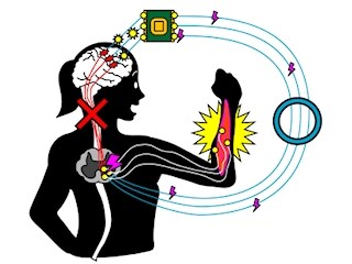 NIPSなど、脳から直接電気信号を引きだし麻痺した手を動かすことに成功
