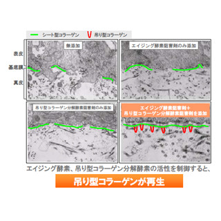 資生堂、肌の吊り型コラーゲンの再生に効果がある新成分を開発