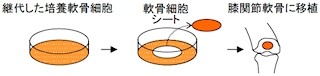 東大、軟骨細胞シートを作成して効率よく「硝子様軟骨組織」の再生に成功