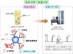 東大病院など、心臓カテーテル検査の実施を簡単に判定できる検査法を