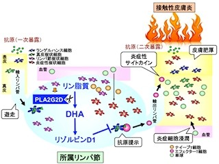 東京都医学研など、脂質成分が炎症にブレーキをかける仕組みを解明