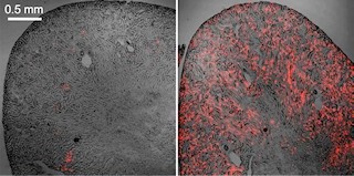 東北大、腎性貧血のモデルマウスの開発に成功