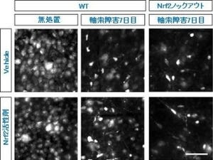 東北大、転写因子「Nrf2」の網膜神経節細胞の死に対する関与などを解明