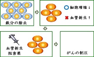 「鉄分を減らして叩く」 - 岡山大、新コンセプトのがん治療法を開発