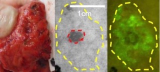 東大、無色透明で体内に漏れると危険なすい液用の蛍光プローブを開発