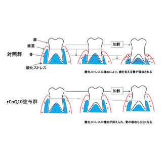 還元型コエンザイムQ10の塗布で歯茎の加齢変化を抑制できる -岡山大が確認