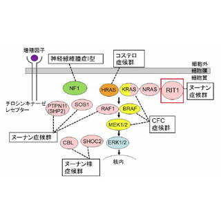 東北大、心筋症を持つ先天性疾患の新たな原因遺伝子を発見