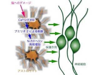 東大、脳の傷害時に神経細胞を保護するメカニズムを発見