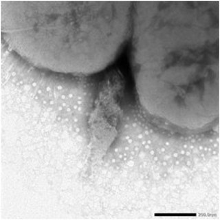 ノロウイルスを特異的に捕捉する腸内細菌 - 北大がその存在を証明