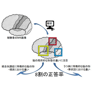 NCNP、MRIを用いた女性向け統合失調症かうつ病かを鑑別する方法を開発