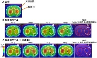 脳の神経細胞のダメージの画像化と治療薬の効果を確認できる技術 - NIRS