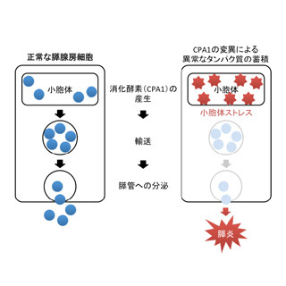 東北大など、若年で発症する膵炎の新規原因遺伝子を発見 | TECH （テックプラス）