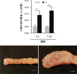 腸管粘膜の異常増殖は細胞内タンパク質輸送因子の異常によるもの -理研など