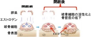 慶応大など、閉経後の骨粗しょう症にはタンパク質「HIF1α」が重要と確認