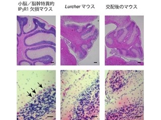 理研、中枢神経系の難治性障害「全身性ジストニア」の仕組みの一部を解明