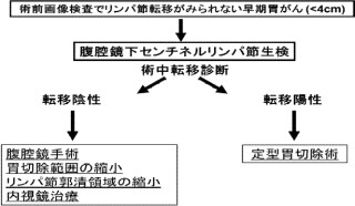 慶応大、胃がんに対する「センチネルリンパ節」生検が有用であると証明