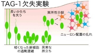 大脳皮質の神経幹細胞が渋滞なく動くことが、大脳の形成にとって重要 -名大