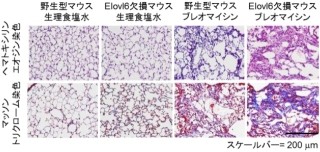 体内の脂肪酸のバランスは肺線維症の発症や症状の悪化に影響 - 群大など