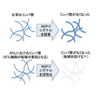 東大、正常組織やがん組織におけるリンパ管の形成を阻害する因子を発見